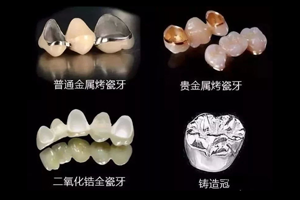 牙密速度PK：闪电矫正VS快速微笑VS迅捷牙贴，谁是真正的最快？