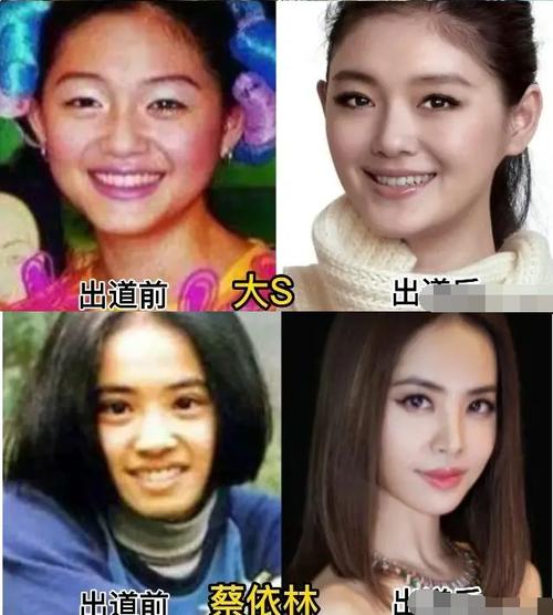 蔡依林整容前后照片_整容蔡依林前后照片对比_整容蔡依林前后照片大全