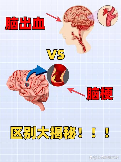 脑浆是什么颜色_脑浆炸裂女孩_脑浆