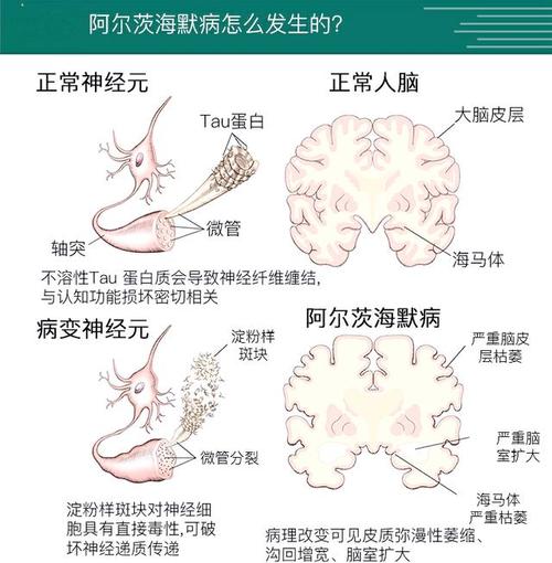 普崔希德教授台词_普崔希德教授_崔希民教授
